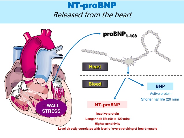 nt-probnp-trong-suy-tim-4-638.jpg